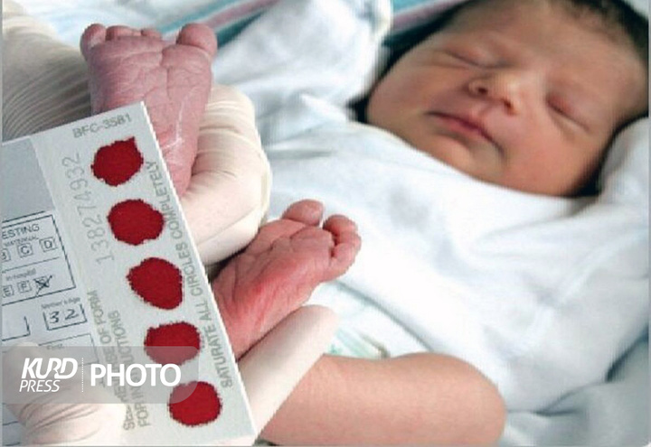ثبت اهدای ۲۵ مورد جنین در مرکز درمان ناباروری سنندج
