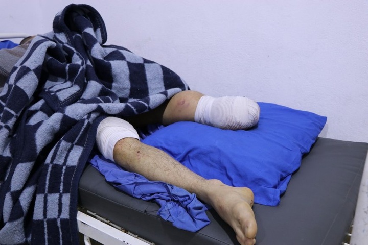 مصدومیت و قطع پای یک شهروند عفرینی بر اثر حملات ارتش ترکیه