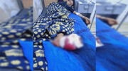 تداوم حملات ترکیه به کانتون شهبا / دو کودک به شدت زخمی شدند