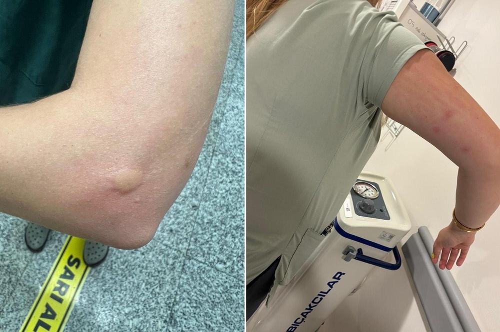 پشه های ناقل بیمارستان تقسیم استانبول را فتح کردند