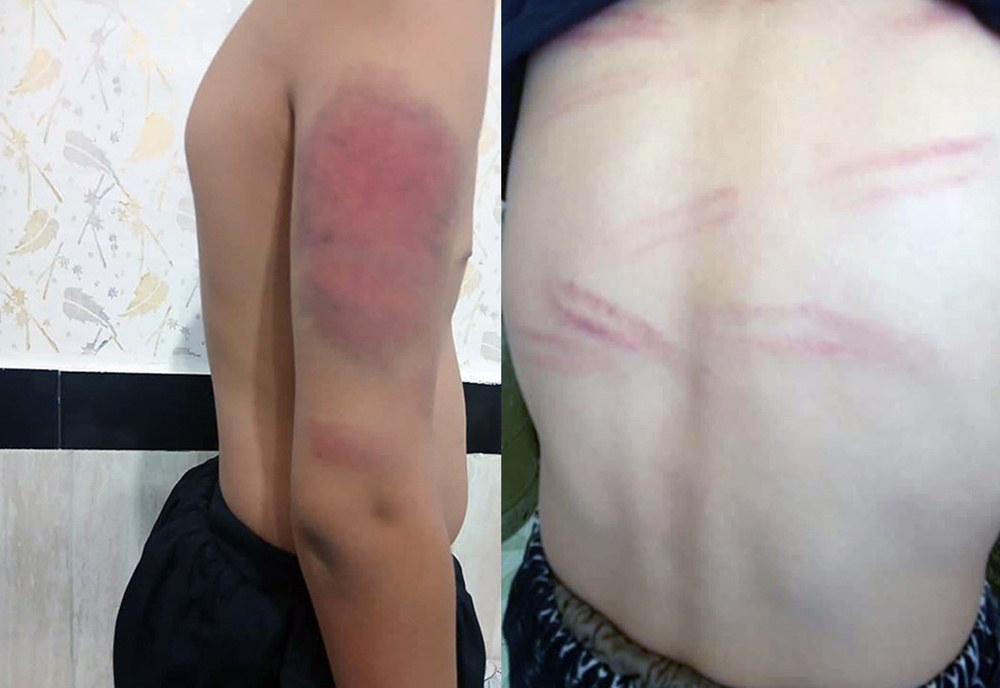 تنبیه فجیع بدنی ۱۲ دانش آموز سنندجی/معلم خاطی اخراج می شود