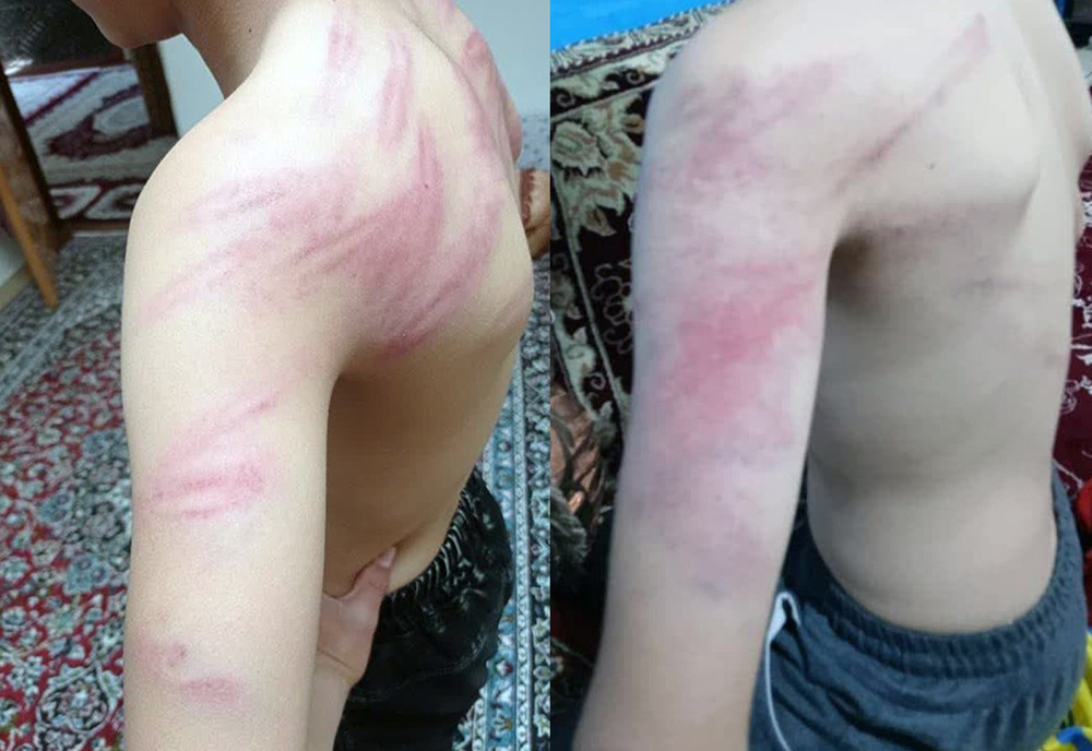 تنبیه فجیع بدنی ۱۲ دانش آموز سنندجی/معلم خاطی اخراج می شود