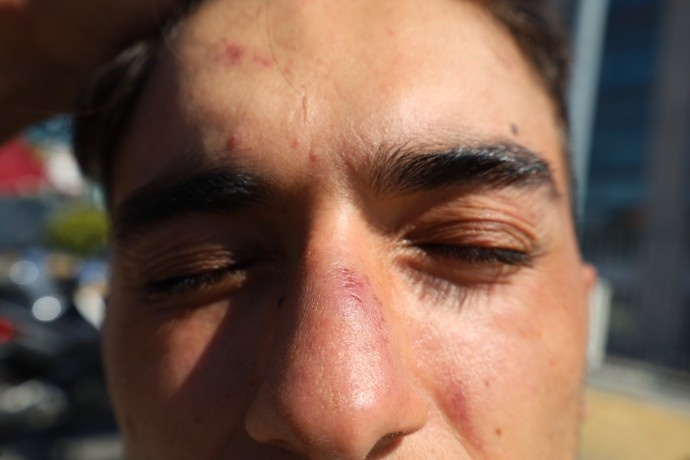 ضربوشتم و بازداشت به دلیل گوش دادن به موسیقی کردی در استانبول/ پلیس: "شما تروریست هستید"