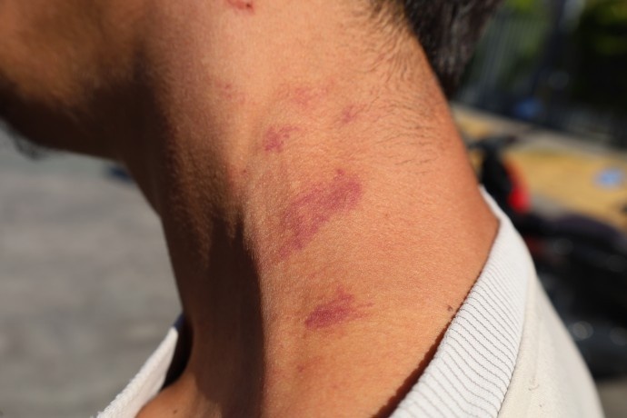 ضربوشتم و بازداشت به دلیل گوش دادن به موسیقی کردی در استانبول/ پلیس: "شما تروریست هستید"