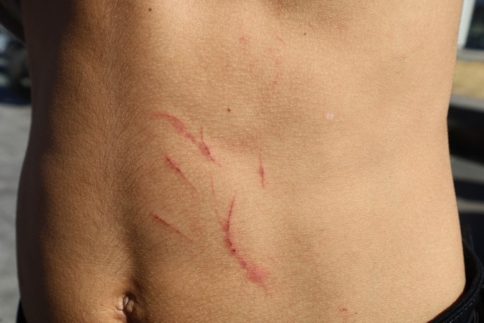 ضربوشتم و بازداشت به دلیل گوش دادن به موسیقی کردی در استانبول/ پلیس: "شما تروریست هستید"