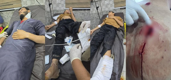 زخمی شدن چهار نفر در حومه دیرالزور در حمله افراد مسلح وابسته به دولت موقت سوریه زخمی شدن چهار نفر در حومه دیرالزور در حمله افراد مسلح وابسته به دولت موقت سوریه
