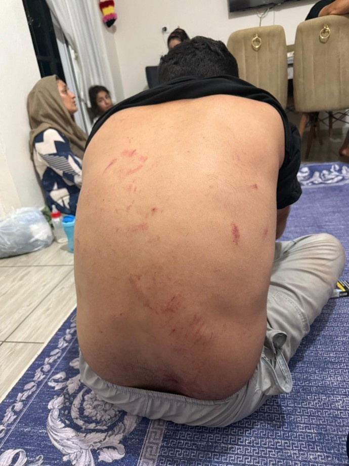 حمله نژادپرستانه به یک خانواده کُرد در مرسین به دلیل سخن گفتن به زبان کُردی