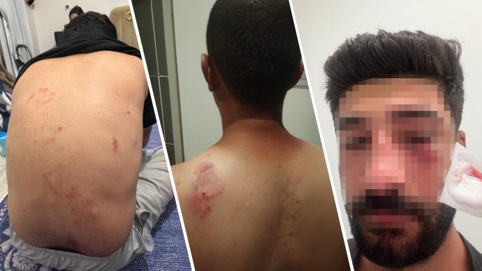 حمله نژادپرستانه به یک خانواده کُرد در مرسین به دلیل سخن گفتن به زبان کُردی
