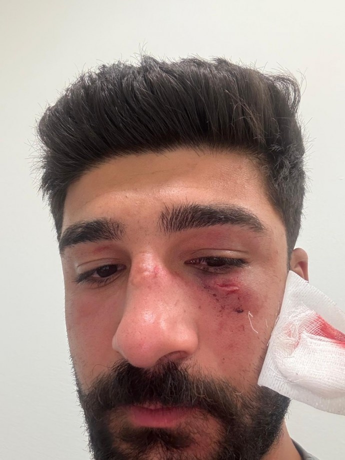 حمله نژادپرستانه به یک خانواده کُرد در مرسین به دلیل سخن گفتن به زبان کُردی