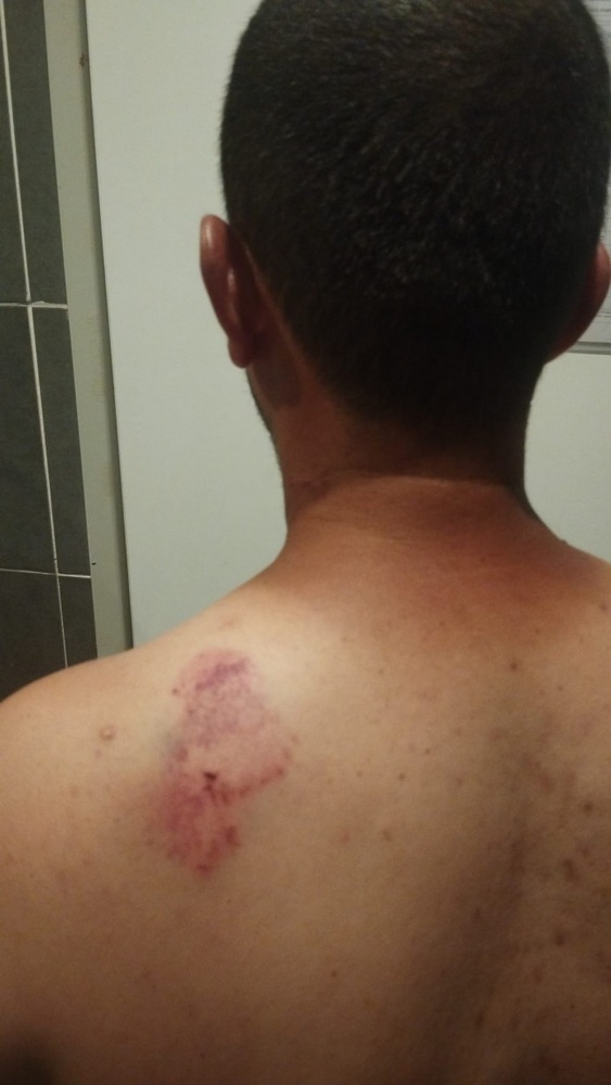 حمله نژادپرستانه به یک خانواده کُرد در مرسین به دلیل سخن گفتن به زبان کُردی