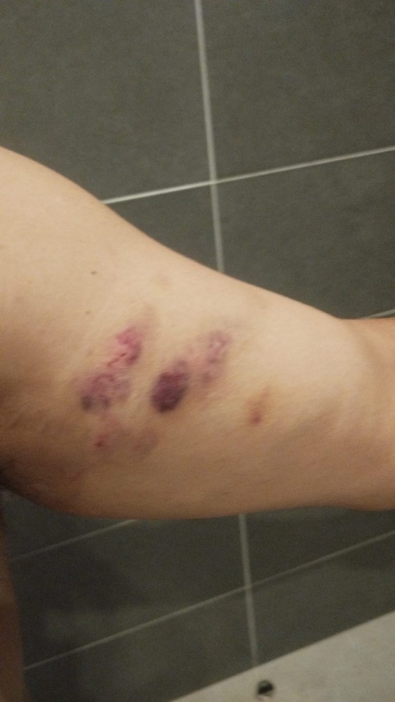 حمله نژادپرستانه به یک خانواده کُرد در مرسین به دلیل سخن گفتن به زبان کُردی