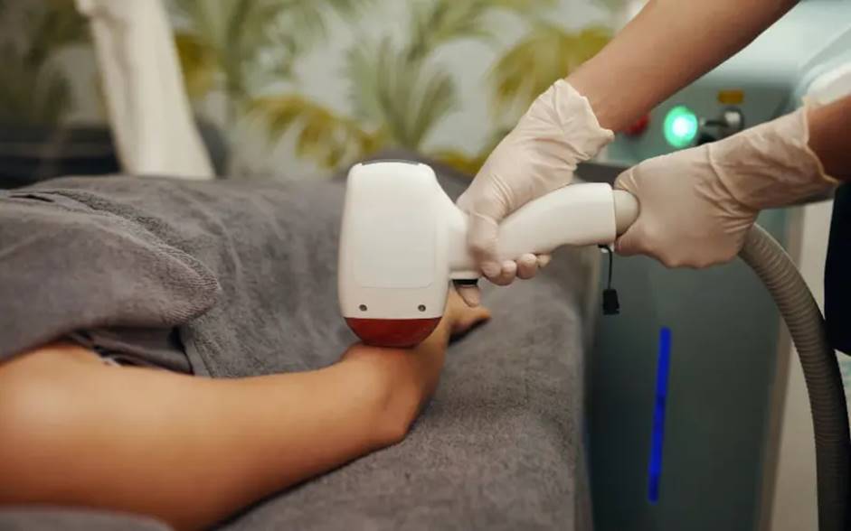 همه آنچه در مورد لیزر مو باید بدانید!