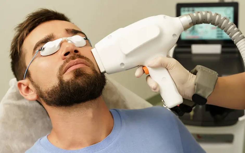 همه آنچه در مورد لیزر مو باید بدانید!