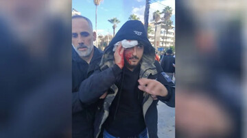 سرکوب تظاهرات علویان سوریه؛ کشته و زخمی شدن معترضان در لاذقیه و طرطوس