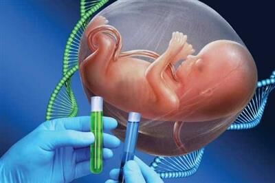 70 درصد ناهنجاری و معلولیت نوزادان در بدو تولد علت ژنتیکی دارد
