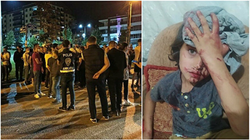 بی توجهی حکومت و پلیس ترکیه به وضعیت کودک سوری که در حمله نژادپرستانه آلتین داغ زخمی شده بود