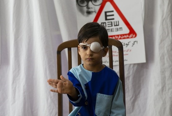 بیش از ۲۰ هزار کودک کردستانی غربالگری بینایی شدند