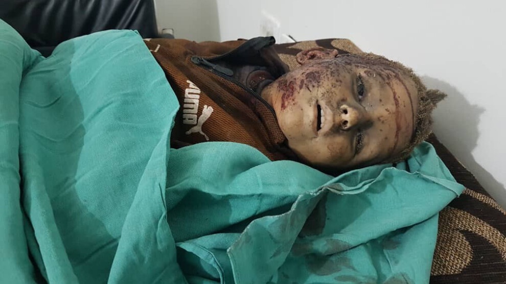 کشته و زخمی شدن 18 غیر نظامی از جمله 4 کودک در حمله ترکیه به کردستان سوریه
