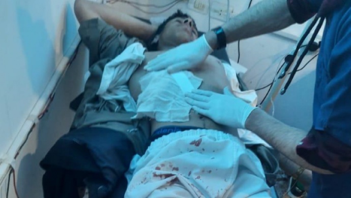در بمباران عین عیسی توسط ارتش ترکیه 3 کودک مجروح شدند