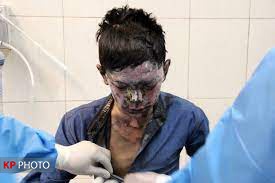 مصدومیت ٦ نفر با مواد محترقه پیش از چهارشنبه سوری