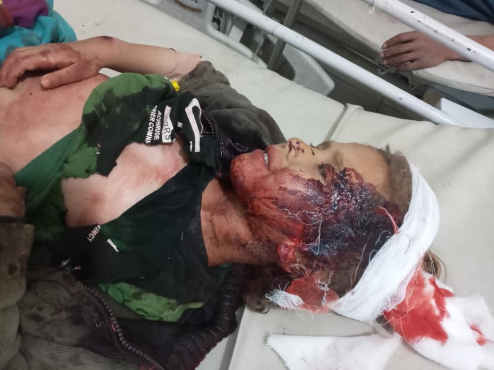 زخمی شدن یک مادر و چهار فرزند بر اثر توپباران  ترکیه در کُردستان سوریه