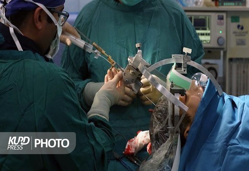 انجام موفقیت آمیز جراحی تومورمغزی در سقز
