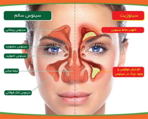 معمای پیچیده درمان یک بیماری ناشناخته